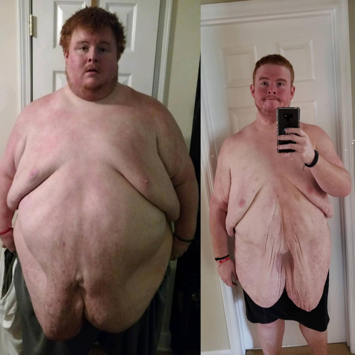 Before and after photos show a shirtless Casey King during different stages of his weight loss program. (Courtesy of <a href="https://www.instagram.com/_caseyking_/">Casey King</a>)