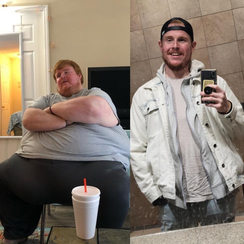 Before and after photos show Casey King as an obese young man and more recently, having undertaken his weight loss program. (Courtesy of <a href="https://www.instagram.com/_caseyking_/">Casey King</a>)