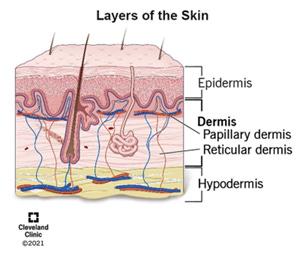 Illustration, Cleveland Clinic. <a href="https://my.clevelandclinic.org/health/body/22357-dermis">https://my.clevelandclinic.org/health/body/22357-dermis</a>