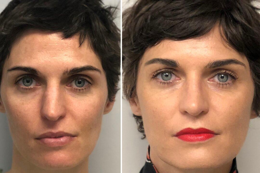 A Conversation With a Real Facial Plastic Surgeon