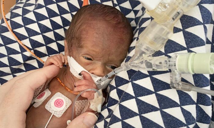 Preemie Who Looked Like a Tiny Doll at Birth Turns 2—Here’s How This Little Miracle Is Doing Now