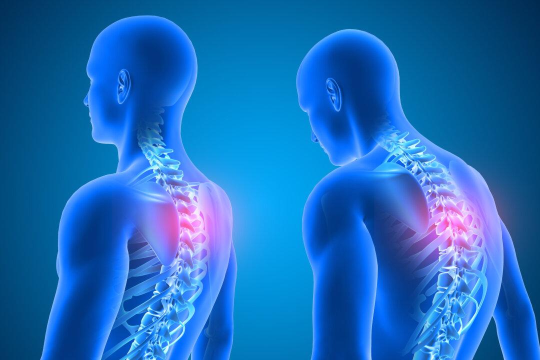 Bad Sitting Habits Lead to Upper Crossed Syndrome; Here Are 3 Simple Stretches to Correct It