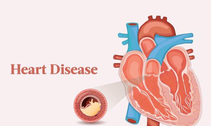 The Essential Guide to Heart Disease: Symptoms, Causes, Treatments, and Other Remedies