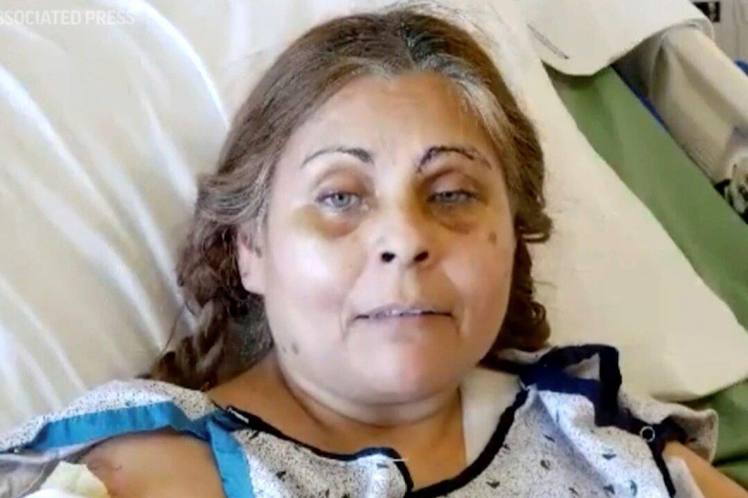 Factory Explosion Survivor, on Fire, Fell Into Chocolate Vat