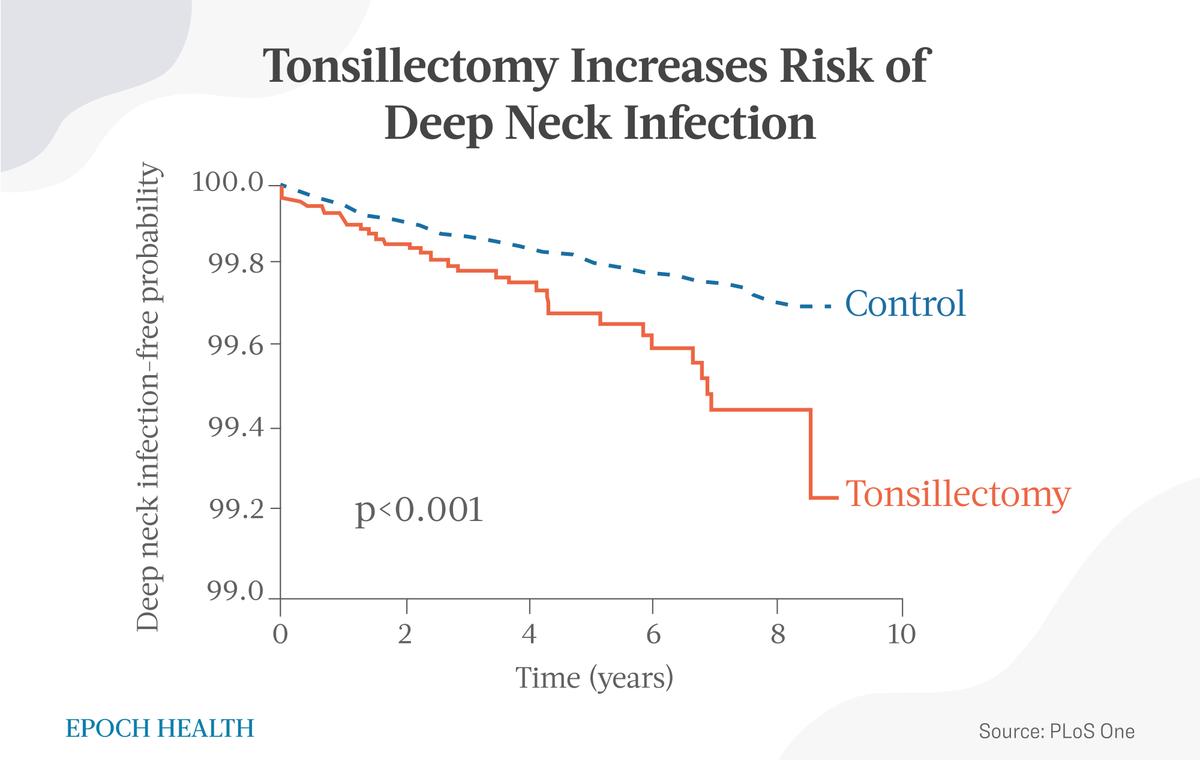 Tonsillectomy increases the risk of deep neck infection. (The Epoch Times)