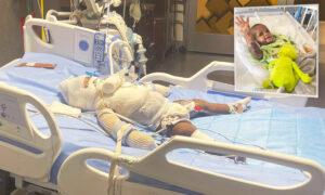 Baby Severely Burned in Candle Explosion Defies the Odds, Proves Nothing Can Dim His Smile