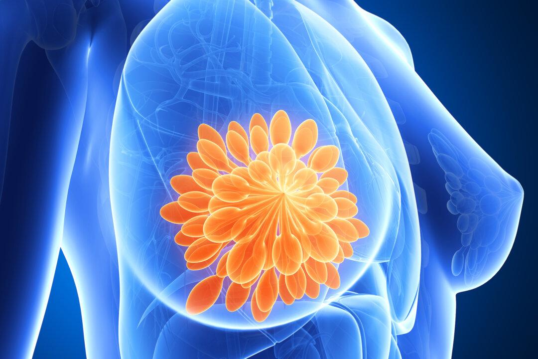 Breast Cancer: High-Risk Groups, Behaviors and 6 Acupoints That Promote Cancer Prevention