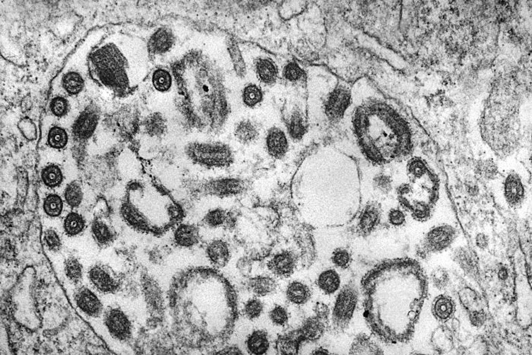 CDC Issues Health Alert to Doctors Over Deadly Ebola-Like Virus