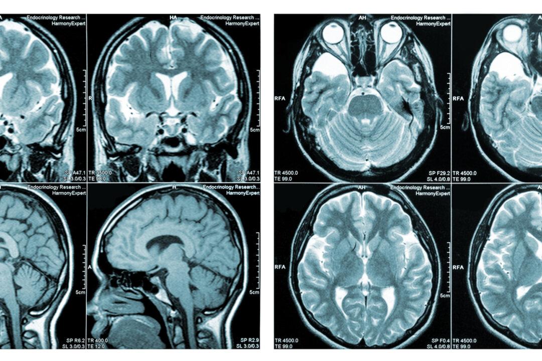 Brain Injuries After COVID Vaccination