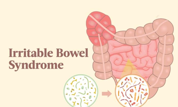 The Essential Guide to Irritable Bowel Syndrome (IBS): Symptoms, Causes, Treatments, and Natural Remedies