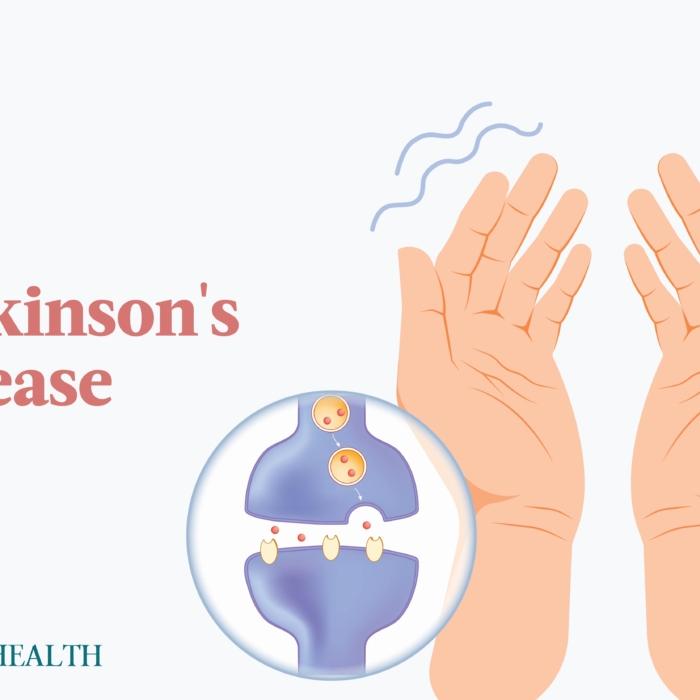 The Essential Guide to Parkinson’s Disease: Symptoms, Causes, Treatments, and Natural Remedies