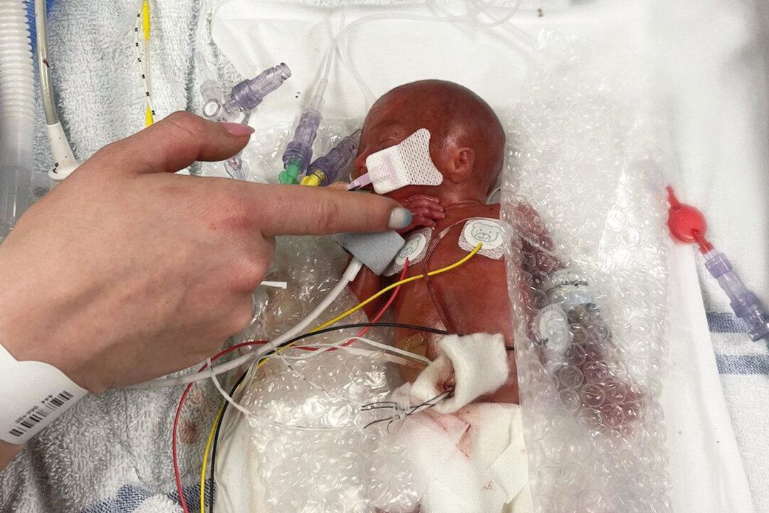 Baby Born Weighing Less Than a Loaf of Bread and Given Only 10 Percent Survival Chance, Celebrates First Birthday