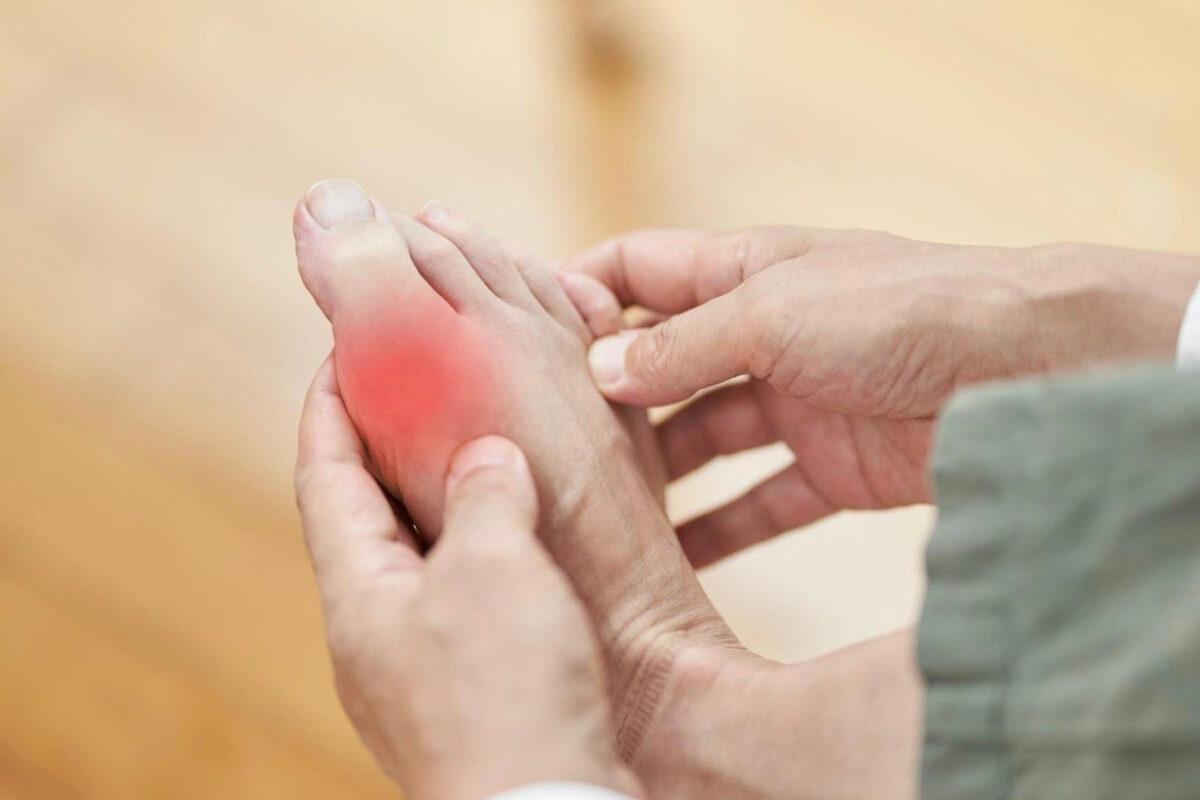 When gout attacks, the big toe suddenly turns red, swollen, and painful. (mapo_japan/shutterstock)