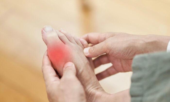 Don’t Let Gout Control Your Life: Try This Ancient Therapy for Fast Relief