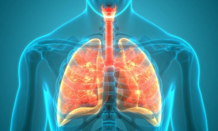 Respiratory Disease Registry Seeks to Combat Silicosis