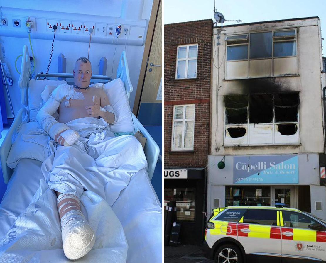 (Left) Kevin Record, 43, in the hospital after sustaining burns from an apartment fire caused by his e-scooter battery's overheating; (Right) Record's apartment sustained "unimaginable damage" from the battery caused by his e-scooter battery's overheating. (Courtesy of <a href="https://www.facebook.com/kentfirerescue">Kent Fire and Rescue Service</a>)