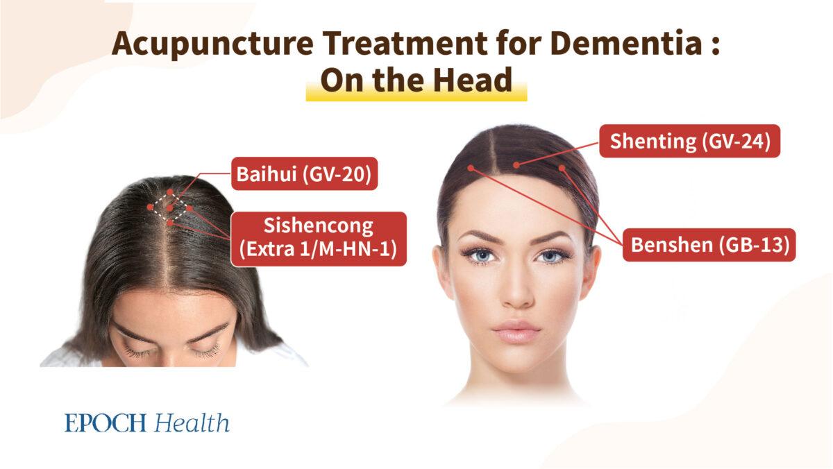 (Epoch Health)