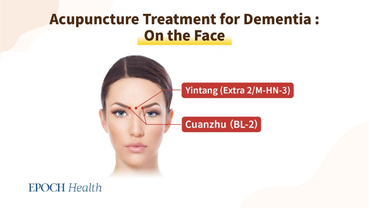 (Epoch Health)