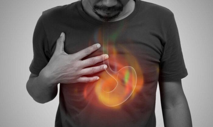 Suffering From Gastroesophageal Reflux? Try These Miraculous Remedies