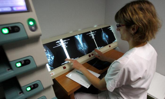 Breast Cancer Screenings Should Start 10 Years Earlier, New Guidelines Say