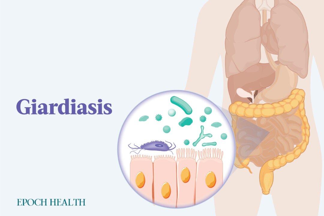 The Essential Guide to Giardiasis: Symptoms, Causes, Treatments, and Natural Approaches