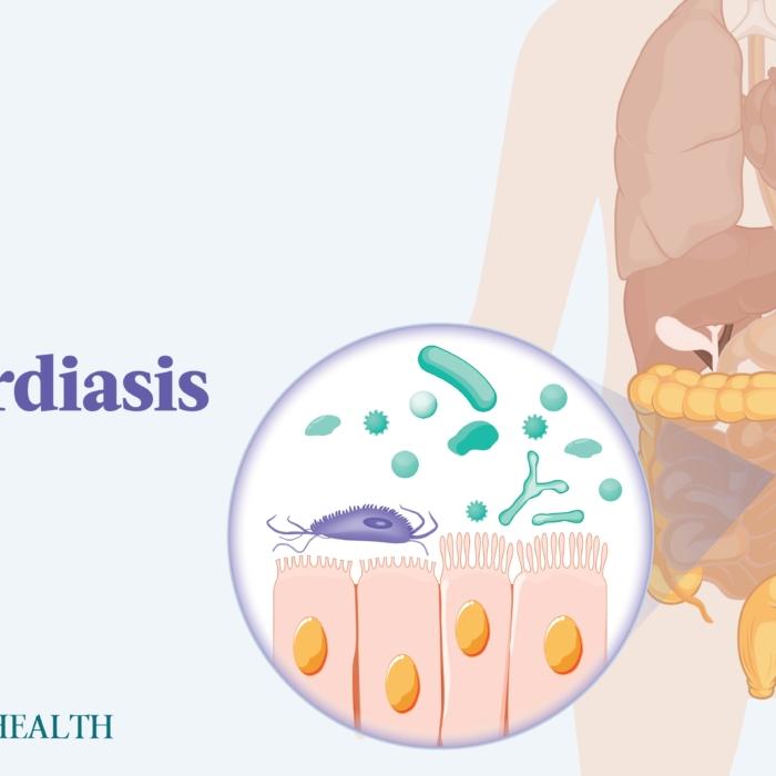 The Essential Guide to Giardiasis: Symptoms, Causes, Treatments, and Natural Approaches