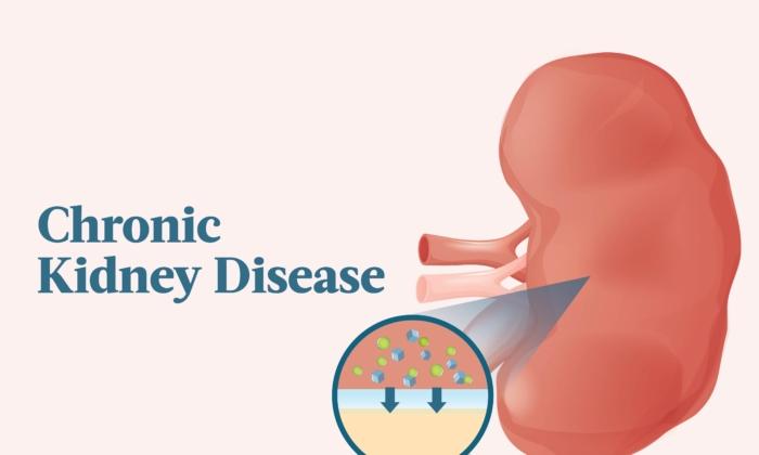 The Essential Guide to Chronic Kidney Disease: Symptoms, Causes, Treatments, and Natural Approaches