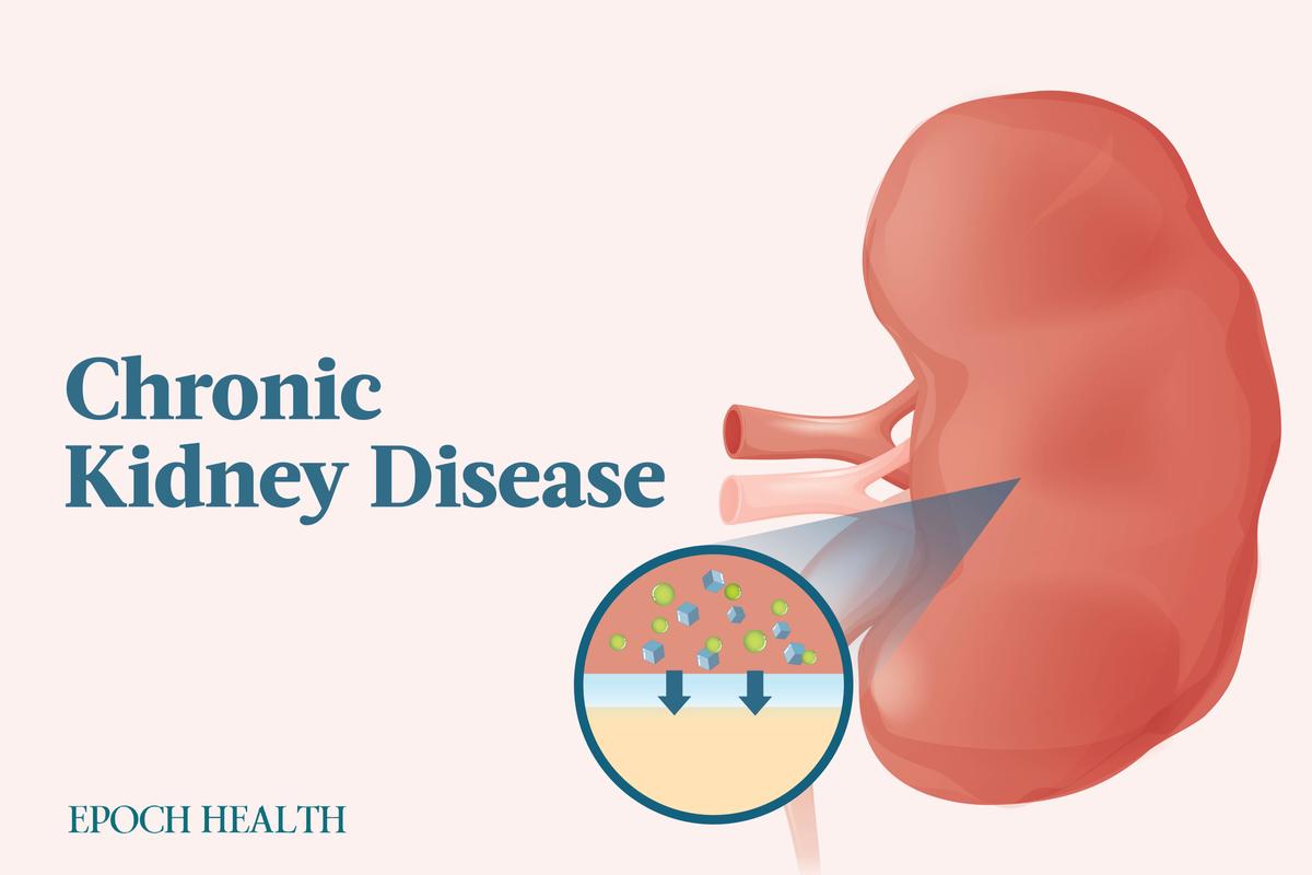 The Essential Guide to Chronic Kidney Disease: Symptoms, Causes, Treatments, and Natural Approaches