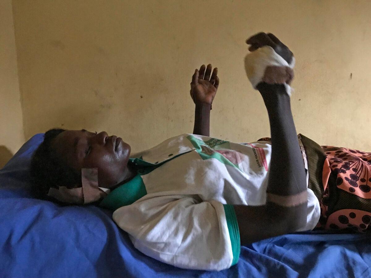 Ribal Danjuma, 26, had her ear and fingers cut off in an attack near Tattara village, Nigeria, on April 28, 2023. (Masara Kim/The Epoch Times)