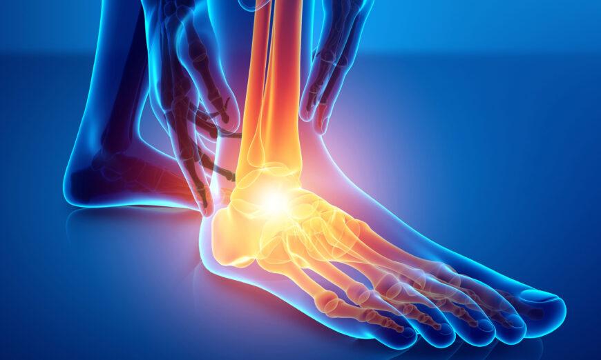 Chronic Foot Pain: 2 Common Causes, 5 Easy Exercises for Relief