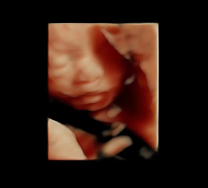 An in-utero photo of baby Denver at 27 weeks and 6 days. (Courtesy of the Coleman family)