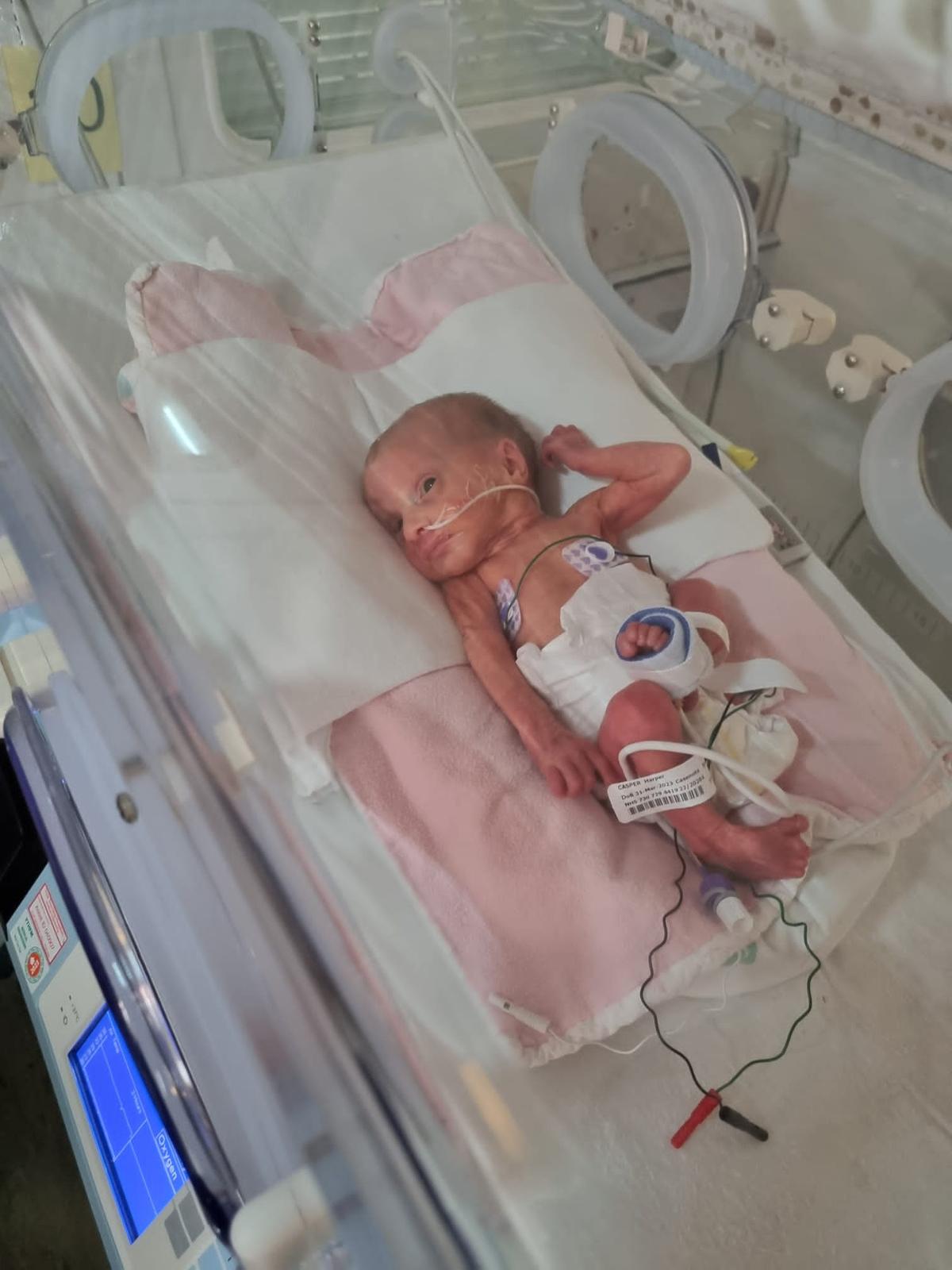 Harper-Gwen Casper when first born, in her incubator. (SWNS)