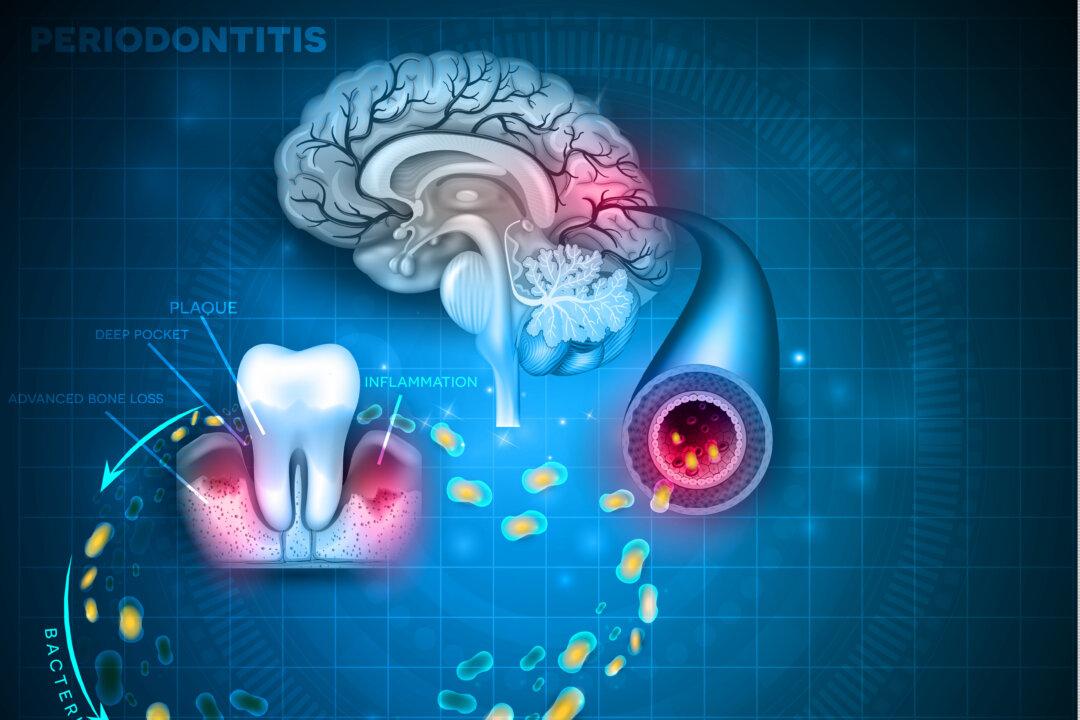 An Important and Overlooked Cause of Alzheimer’s