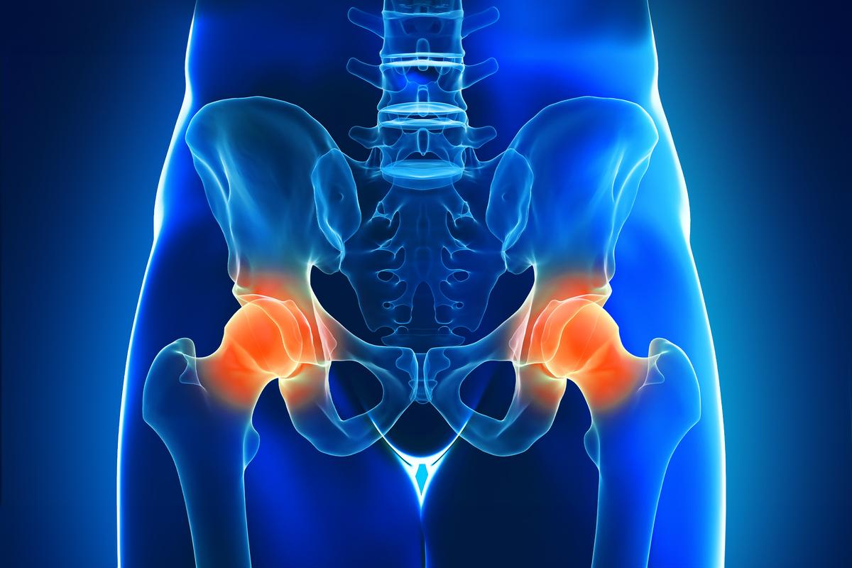 Chronic Hip Pain: Common Causes, 5 Exercises to Relieve