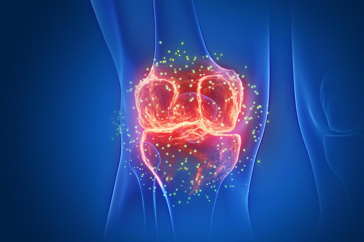 Chronic Knee Pain: 2nd Leading Cause of Pain, 5 Easy Home Exercises to Relieve