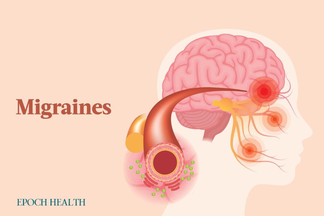 The Essential Guide to Migraines: Symptoms, Causes, Treatments, and Natural Approaches