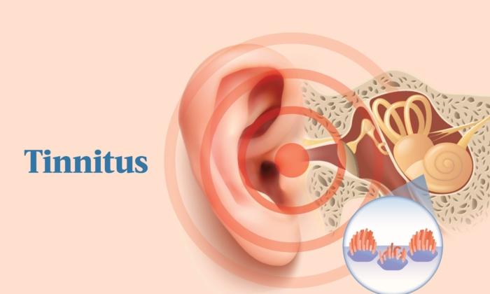 The Essential Guide to Tinnitus: Symptoms, Causes, Treatments, and Natural Approaches