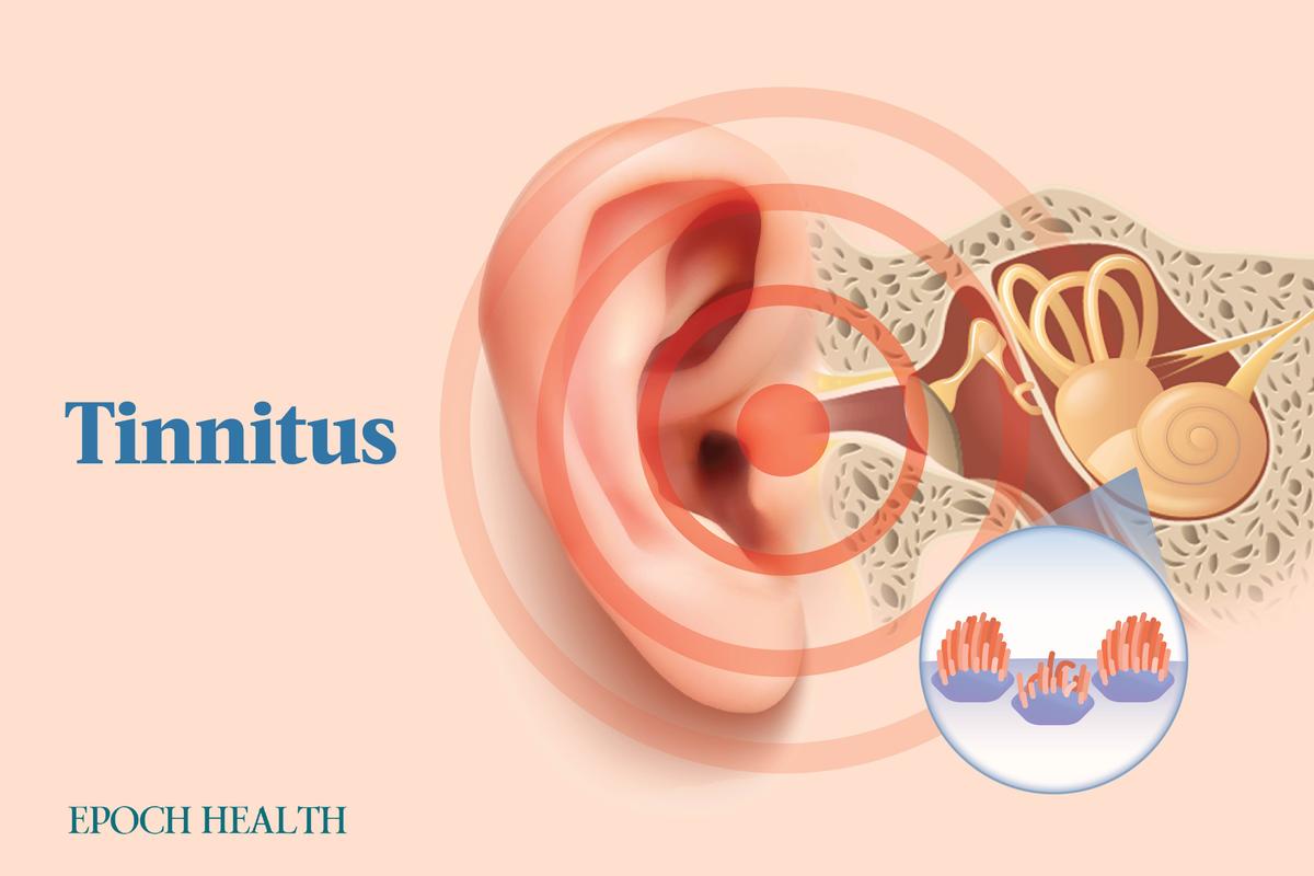 The Essential Guide to Tinnitus: Symptoms, Causes, Treatments, and Natural Approaches