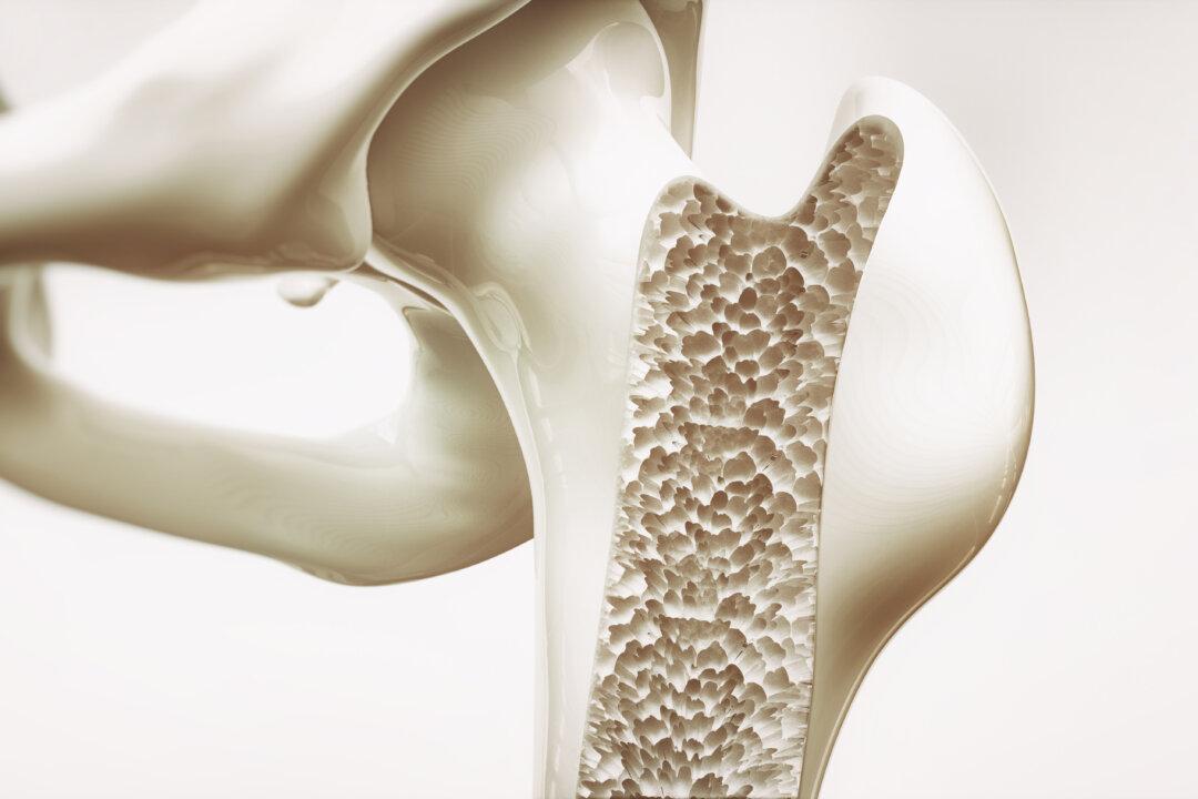 A Functional Approach to Osteoporosis and Bone Health