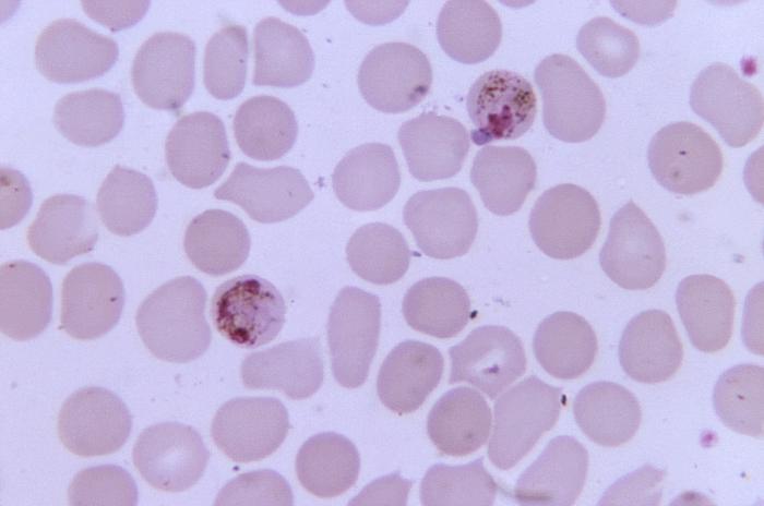 This thin film blood smear photomicrograph reveals the presence of two Plasmodium malariae schizonts, which cause malaria. (Dr. Mae Melvin/CDC)