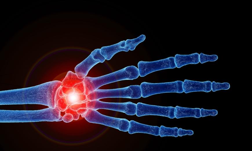 Chronic Wrist Pain: Can Last for Years, a Therapist's Top Exercises to Relieve