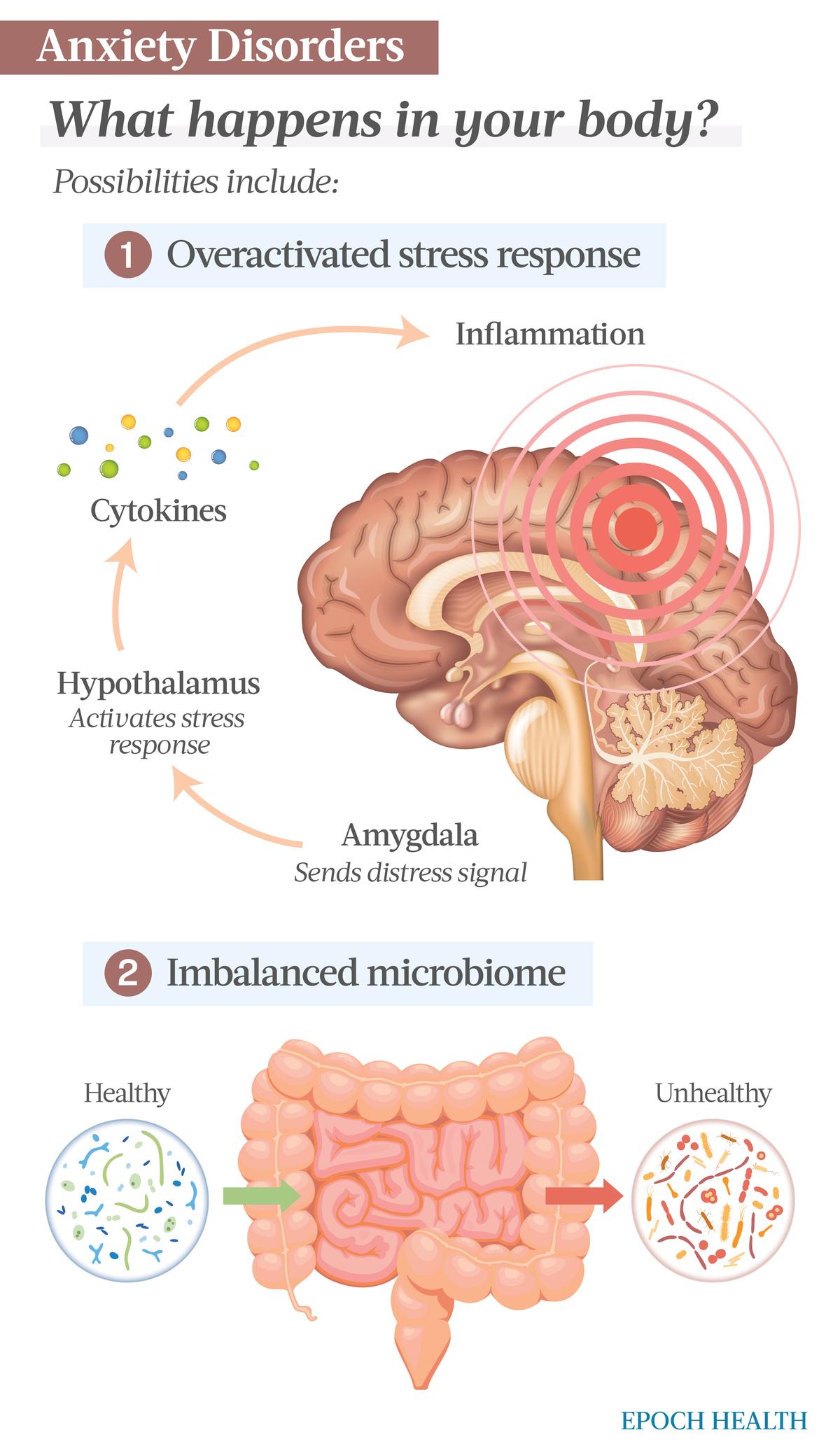 The amygdala sends out a distress signal, which prompts the hypothalamus to activate the body's stress response. This releases cytokines and creates inflammation in the brain. (The Epoch Times)