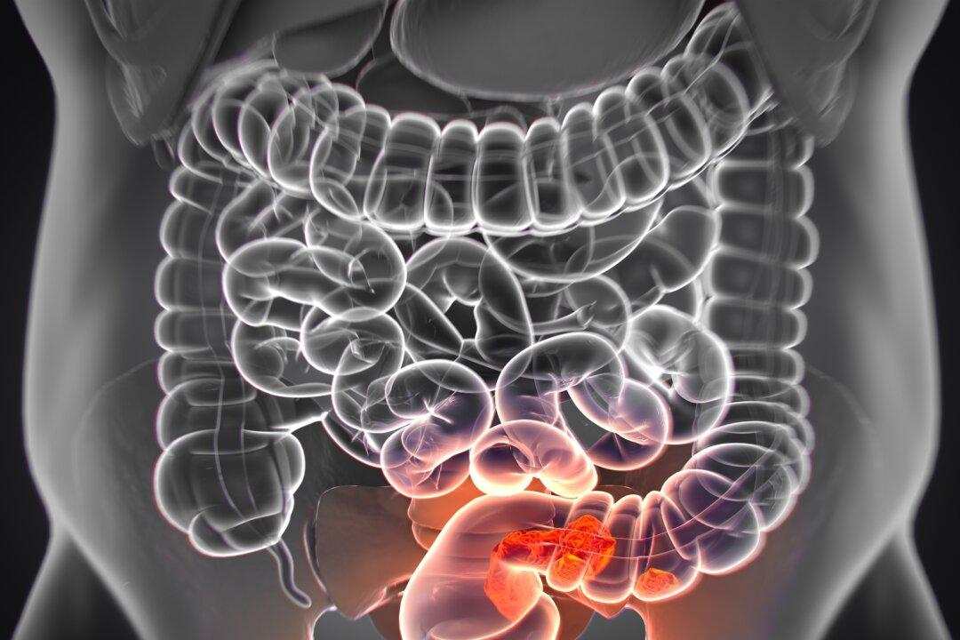 8 Major Risk Factors for Colorectal Cancer and 3 Tips for Nurturing Digestive Health