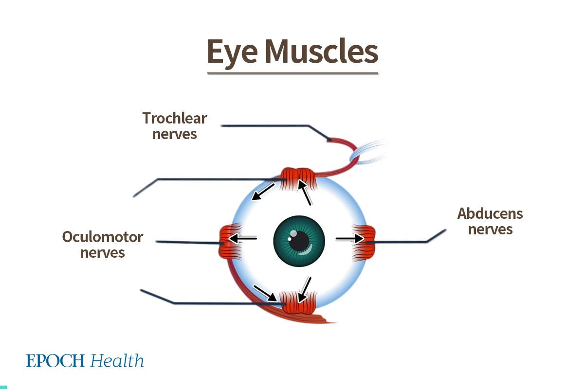 Problems with eye muscles often cause double vision. The abducens, oculomotor, and trochlear nerves drive the activity of eye muscles. (The Epoch Times)