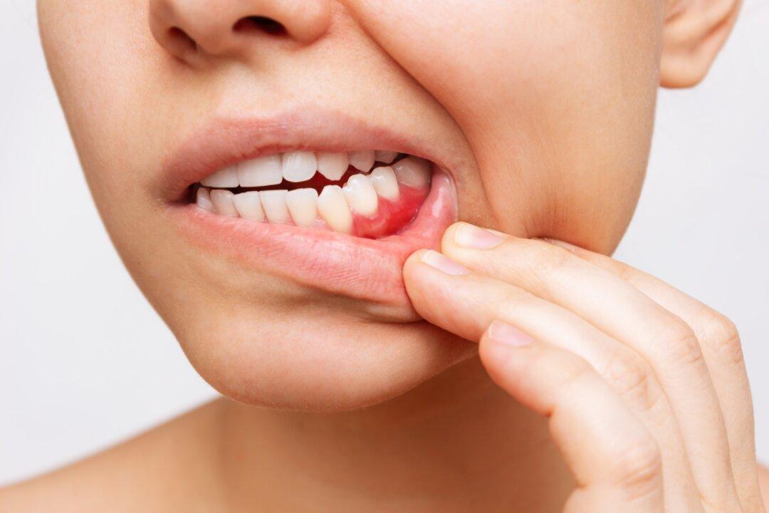Periodontal Disease Doesn’t Start in the Mouth