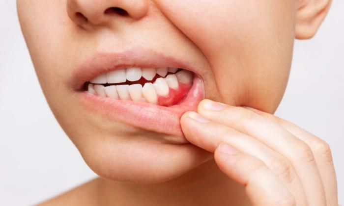 Periodontal Disease Doesn’t Start in the Mouth