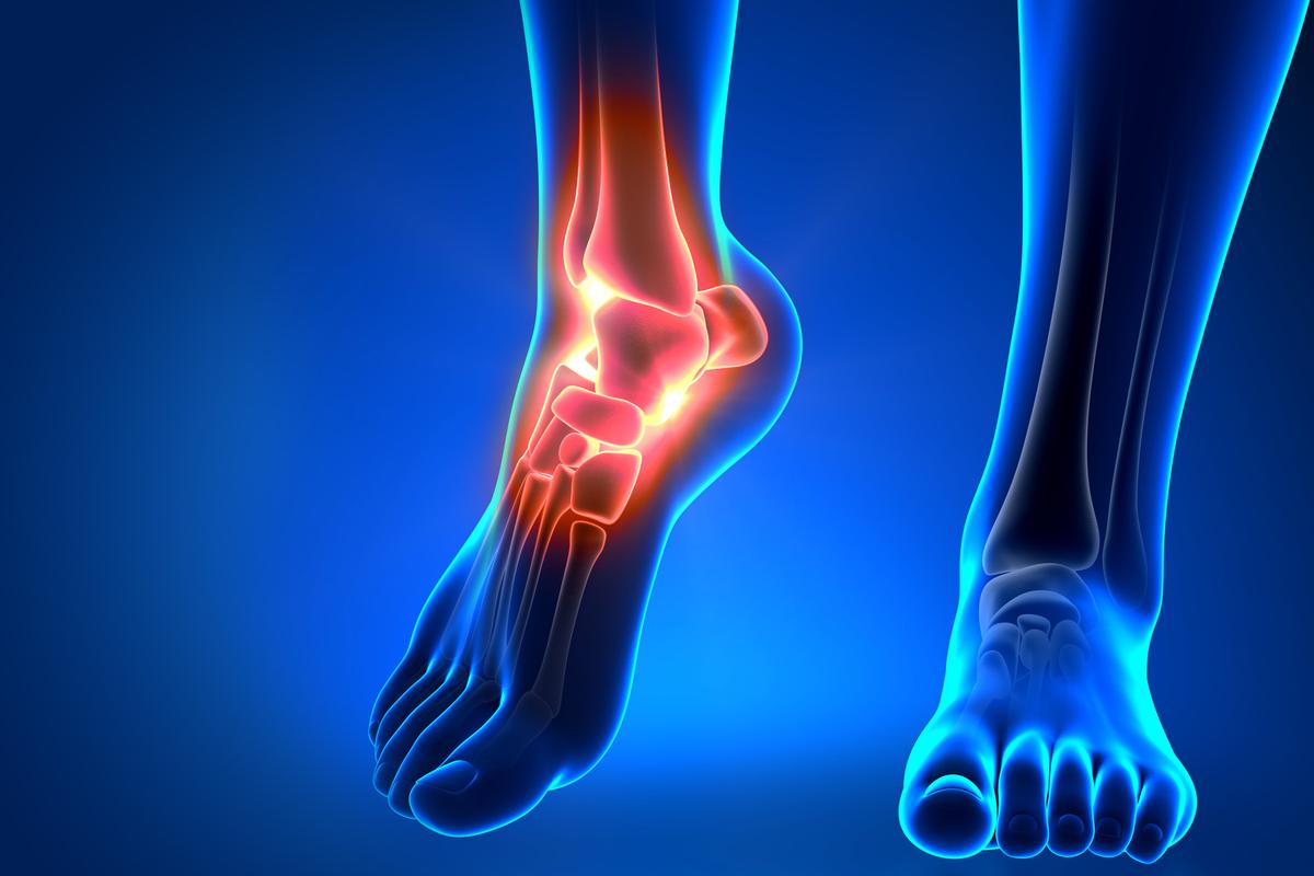 Chronic Ankle Pain: Often Caused by Weak Ankles, 5 Exercises to Strengthen and Prevent Injury