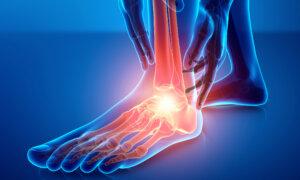 Chronic Foot Pain: 2 Common Causes, 5 Easy Exercises for Relief