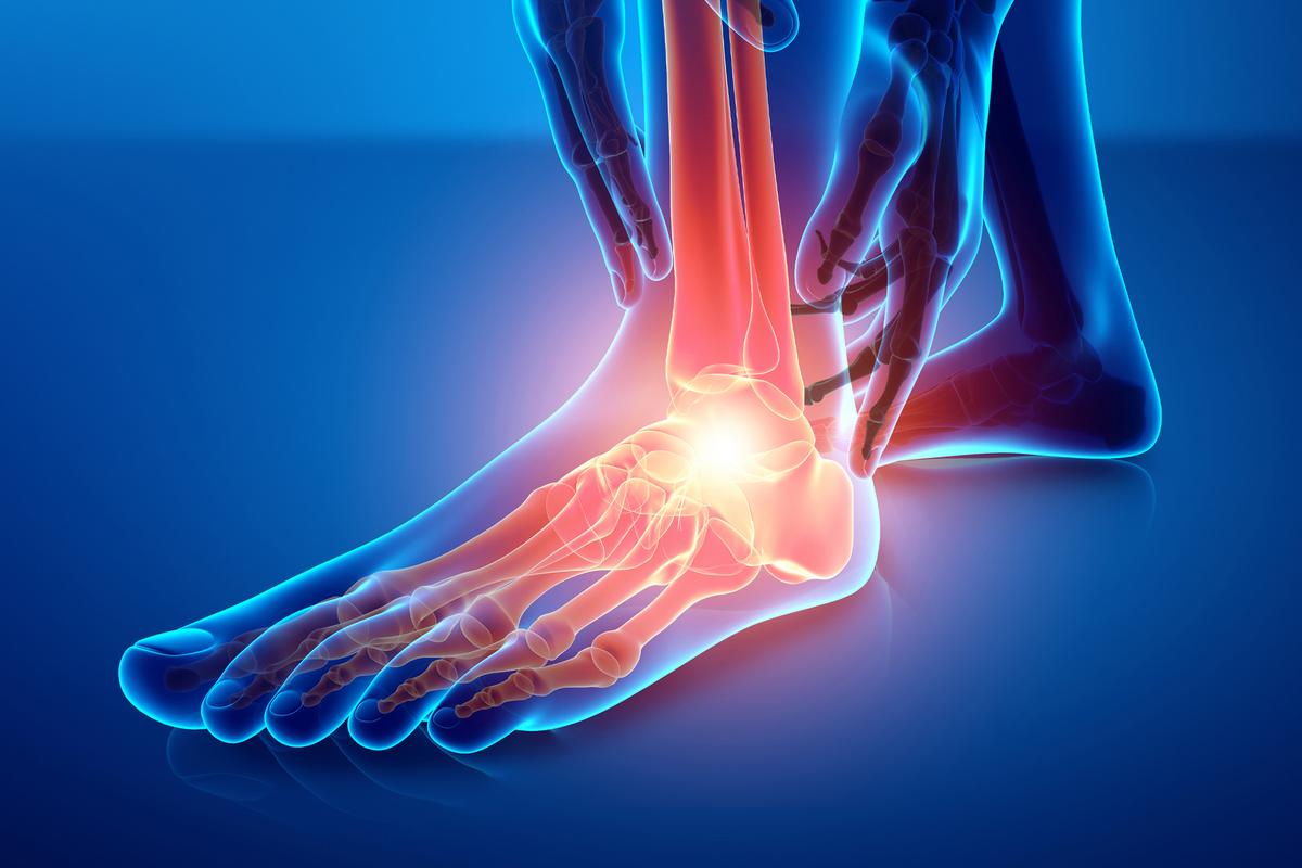 Chronic Foot Pain: 2 Common Causes, 5 Easy Exercises for Relief