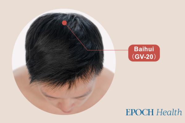  Baihui acupoint is about 1 thumb width posterior to the vertex of the head, which is approximately at the midpoint of the line connecting the apexes of both ears. <span style="font-size: 16px;">(The Epoch Times)</span>